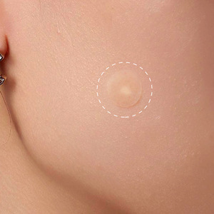 Est Elling EW Kin son roducts CCNE pot rereatment 36PCs nvisible yydrocoloid imimple Patches - Product Image 2