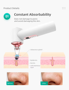 Nouveau <span class=keywords><strong>aspirateur</strong></span> électrique pour pores de beauté dissolvant de points noirs nettoyant pour pores du visage dissolvant de tête noire pour le visage - Product Image 3
