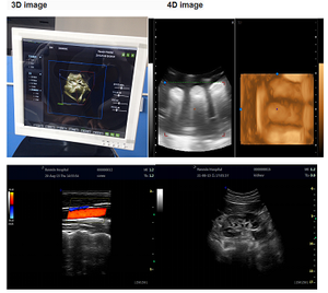 TC15 mesin <span class=keywords><strong>Ultrasound</strong></span>, sistem diagnostik Digital penuh <span class=keywords><strong>3D</strong></span> 4D Trolly warna - Product Image 3