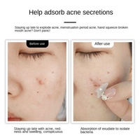 Patchs Hydrocolloïdes Transparents pour l'Acné aux Huiles Essentielles - 36 Pièces - Camouflent les Imperfections et Permettent l'Application du Maquillage