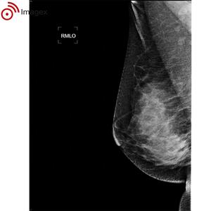 Appareil de mammographie numérique abordable pour le dépistage vétérinaire et médical - Product Image 3