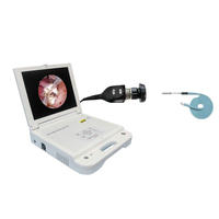 Endoscope chirurgical 17 pouces pour ORL (oreille, nez, gorge) avec caméra 1080p pour usage vétérinaire