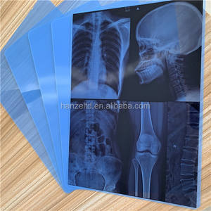 Película Médica de Impresión por Inyección de Tinta, Base Azul, Radiología Seca, Impresión de Rayos X, DR, CR, <span class=keywords><strong>CT</strong></span> - Product Image 2