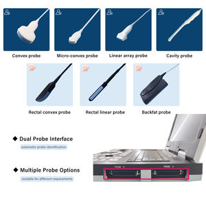 Les animaux de plate-forme PC utilisent une machine de balayage ultra sonore entièrement numérique portable à ultrasons de 15 pouces pour l'homme avec sonde convexe - Product Image 5