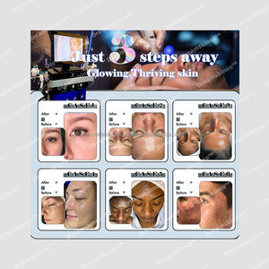 Nueva Generación de hidrodermoabrasión para el cuidado de la piel Nueva máquina de belleza facial Hydro Water Peel pour le soin de visage acne - Product Image 6