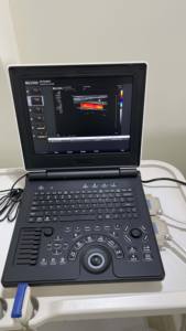 Máquina de Ultrasonido <span class=keywords><strong>Doppler</strong></span> Color Portátil 3D 4D Lista para Enviar, la Más Económica en Oferta, para Uso Humano y Veterinario - Product Image 2