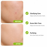 Sérum OEM à l'acide azélaïque, au kojic et à l'arbre à thé pour un soin clarifiant, unifiant le teint, produit de soin quotidien pour le visage, Soins du Visage