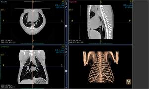 Scanner TC 3D Veterinario per Cani con Scansione Rapida, Touchscreen, Molteplici Modalità di Ricostruzione, Basso Dosaggio di Radiazioni, Riutilizzabile - Product Image 6