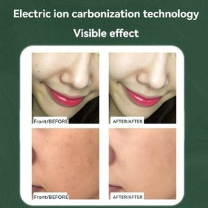 Kit de Lápiz Portátil para Eliminar Verrugas y Acrocordones, Uso Doméstico, Gran Venta 2025 - Product Image 6