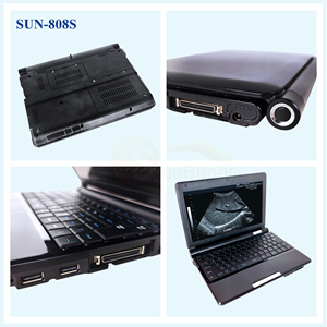 เครื่องอัลตราซาวนด์สัตว์แบบพกพา ขาวดำ สำหรับสัตว์ต่างๆ เช่น สุนัข แมว แกะ หมู วัว ม้า - Product Image 2