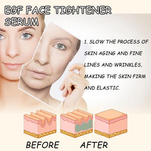 Venta al por mayor de ingredientes suaves adecuados para todo tipo de piel más brillante para conseguir un suero tensor facial - Product Image 5