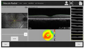 Tomografía de Coherencia Ó<span class=keywords><strong>ptica</strong></span> OCT-500 de Alta Precisión y Tecnología Avanzada, Mejor Precio, Gran Venta - Product Image 3