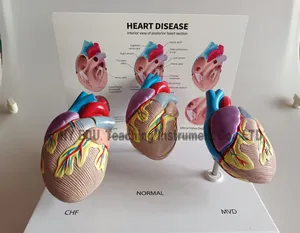 Высококачественная медицинская образовательная модель из 3 частей сердечных заболеваний