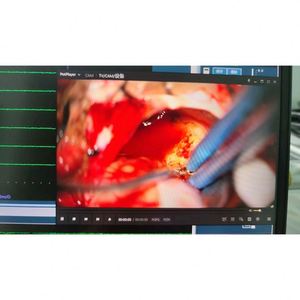 Y tế ionm hệ thống giám sát thần kinh hệ thống cho Ent/tuyến giáp phẫu thuật để Bán thiết bị phẫu thuật - Product Image 4