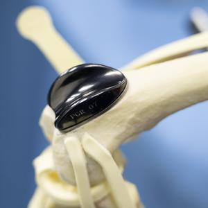 Bluesaoサイズ7プロの獣医膝蓋骨溝置換手術移植されたプロ装具 (溝とプレート) 、チタン - Product Image 2