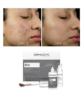 Traitement Dermaceutic Milk Peel 60ml, exfoliant, peeling au lait contre l'acné, 60ml, soin du corps, Luthione <span class=keywords><strong>Cindella</strong></span>, éclaircissant, contre l'acné - Product Image 4