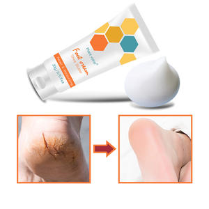 Vente en gros crème cosmétique hydratante en profondeur crème blanchissante pour les mains et lotion pour les pieds pour les soins <span class=keywords><strong>de</strong></span> la peau fissurée - Product Image 5