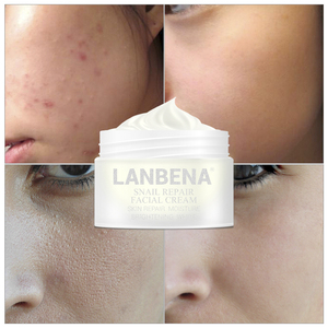 LANBENA baba de caracol <span class=keywords><strong>Crema</strong></span> de Cara <span class=keywords><strong>crema</strong></span> facial <span class=keywords><strong>hidratante</strong></span> suero - Product Image 5