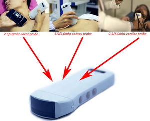 Konted MDR Konted elementi 128 colore Doppler portatile wireless 3 in 1 sonda convessa/lineare/cardias/trasduttore/Scanner - Product Image 5