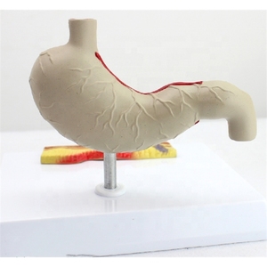 Nhà máy PVC giải phẫu mô hình cho dạ dày bệnh lý thủng và loét phần tăng cường thông tin liên lạc giảm Giải Thích - Product Image 4