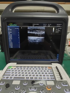 Appareil d'échographie Doppler couleur numérique complet DMU77 avec écran LCD de 15 pouces, instrument de diagnostic médical portable - Product Image 6
