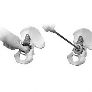 Cage de soutien pour révision acétabulaire d'implant médical orthopédique 46A/46B pour la reconstruction complexe de l'arthroplastie totale de la hanche - Product Image 5