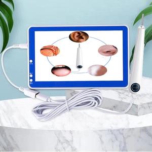Limpiador de Oídos Inteligente con Endoscopio HD Eléctrico, Cuchara Digital para Remover Cera de Oídos con Microscopio, Limpiador Visual de Oídos - Product Image 5
