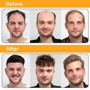 Toupet da <span class=keywords><strong>Uomo</strong></span> Ultra Sottile in PU con Capelli Umani Protesi per <span class=keywords><strong>Uomo</strong></span> con V-Loop Senza Nodi Attaccatura Naturale Sistema di Infoltimento Capillare - Product Image 5