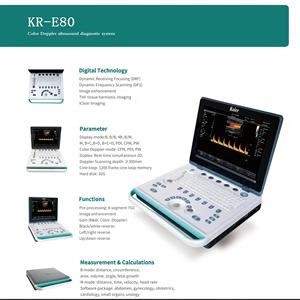 Siêu âm xách tay Thiết bị chẩn đoán tim mạch máu siêu âm DOPPLER màu Echo máy siêu âm - Product Image 2