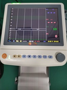 Equipamento Hospitalar: Máquina Cardiotocógrafo (CTG) com <span class=keywords><strong>Monitor</strong></span> <span class=keywords><strong>Fetal</strong></span> de <span class=keywords><strong>12.1</strong></span> polegadas - Product Image 4
