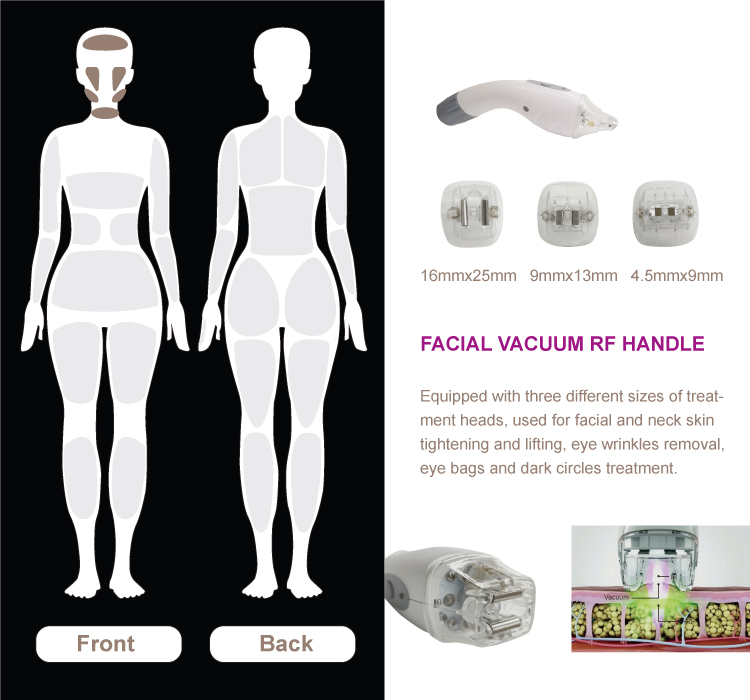 800w 2mhz Rf Body Sculpting Machine Cellulite Reduction Vacuum Shape Machine