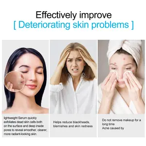 SEFUDUN深い角質除去毛穴をきれいにする肌を明るくする顔の美容液アンチエイジングニキビ跡BHAケイ酸液体を減らす