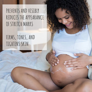 Humectante diario de marca privada, crema de marcas de estiramiento para el embarazo, aceite de planta de cacao orgánico, vitamina A - Product Image 2