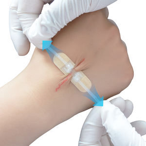 Médico cirúrgico Zip-Stitch Suturas Band Aids Emergência 46*10mm Ferida Fechamento Tiras Ferida Flexível Fechamento Tiras - Product Image 1