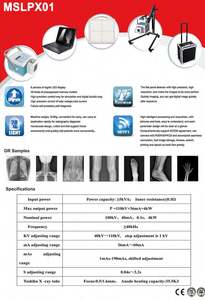 الأكثر مبيعًا من MEDSINGLONG ، جهاز الأشعة السينية المحمول بشاشة تعمل باللمس بوصة ، للاختبار الروتيني للإنسان والطبيب البيطري في المستشفيات - Product Image 6