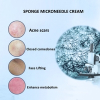 Microneedles non invasives sans aiguille à base d'algues pour le visage, réparation de l'acné, cicatrices, éclaircissement de la peau personnalisé
