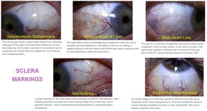 12MP HD 30x Iris Lens Otomatik Odaklama Cilt Analizörü, USB2.0/3.0 Sürücüsüz Yazılım ile Vücut/Göz Analizi için Ev ve Ticari Kullanım - Product Image 6