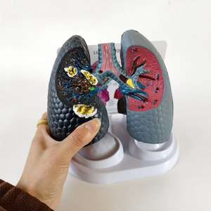 Modelo Anatómico Patológico de Corazón y Pulmón Humano con Imágenes - Medicina - Modelo del Sistema Respiratorio Pulmonar - Product Image 4