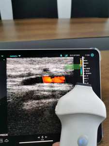 SURESULT L20 Sonda de ultrasonido de mano médica profesional Dispositivo de color lineal alimentado eléctrico para análisis de líneas finas de arrugas - Product Image 4