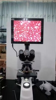 Analizador Hematológico Automático de 3 Diferenciales para Uso Humano