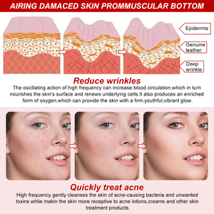 LZ006A Appareil portable haute fréquence le plus vendu pour usage domestique, baguette de thérapie cutanée haute fréquence, machine faciale portative - Product Image 6
