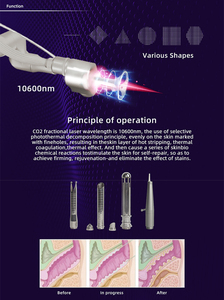 เครื่องเลเซอร์ CO2 Fractional 10600 นาโนเมตร 1000 วัตต์ 2-in-1 สำหรับฟื้นฟูผิวและกระชับช่องคลอด ลดรอยดำ รอยแผลเป็น และริ้วรอย - Product Image 5
