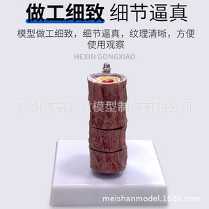 Modèle vasculaire humain ; vaisseaux sanguins/occlusion ; vaisseaux sanguins chez les personnes âgées ; embolie/blocage/modèle ; modèle vasculaire/PATHOLOGIQUE - Product Image 4