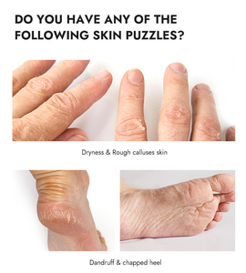 <span class=keywords><strong>Masque</strong></span> de beauté pour les <span class=keywords><strong>mains</strong></span> et les pieds en paraffine entièrement raffinée, jetable, pour usage domestique, vente en gros - Product Image 4