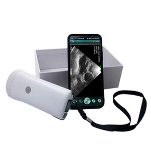 Escáner de Ultrasonido Veterinario Inalámbrico de 8 Canales y 80 Elementos, Sonda Convexa Portátil Android, Detección de Gestación en Cerdas y Ovejas, IPX6 - Product Image 1