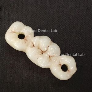Puente de Zirconia para dentaduras postizas de implante adecuado para la mayoría de los postes de escaneo del sistema de implante se pueden proporcionar <span class=keywords><strong>Freey</strong></span> - Product Image 6