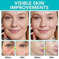 Masques pour les yeux YECUCEY à micro-aiguilles, réduisent les poches et les cernes, raffermissent et atténuent les rides du sourire, patchs oculaires à micro-aiguilles