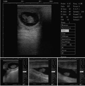 Ecógrafo Veterinario DMSU29, Fabricante Chino, Sonda Rectal Inalámbrica para Diagnóstico Reproductivo en Vacas y Yeguas - Product Image 6