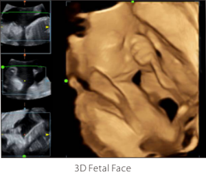 Ecógrafo de Carro <span class=keywords><strong>Mindray</strong></span> <span class=keywords><strong>DC</strong></span>-26 <span class=keywords><strong>DC</strong></span>-<span class=keywords><strong>30</strong></span>, Sistema de Escáner de Ultrasonido a Color 4D 3D en Tiempo Real - Product Image 6