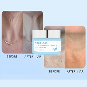 <span class=keywords><strong>Crema</strong></span> Personalizzata Rassodante e Lifting <span class=keywords><strong>per</strong></span> <span class=keywords><strong>Collo</strong></span> e Viso, Migliora la Pelle del <span class=keywords><strong>Collo</strong></span> <span class=keywords><strong>Cadente</strong></span>, Uniforma il Tono della Pelle e Riduce le Rughe Sottili - Product Image 2
